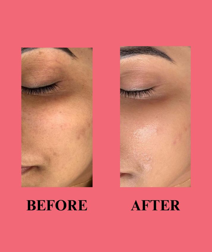 Vitamin C facewash