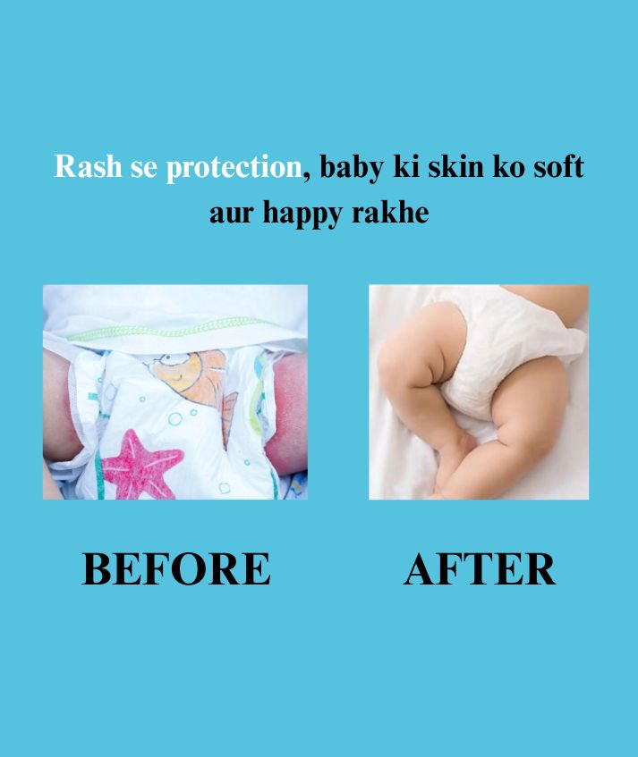 Baby Nappy Rash Cream