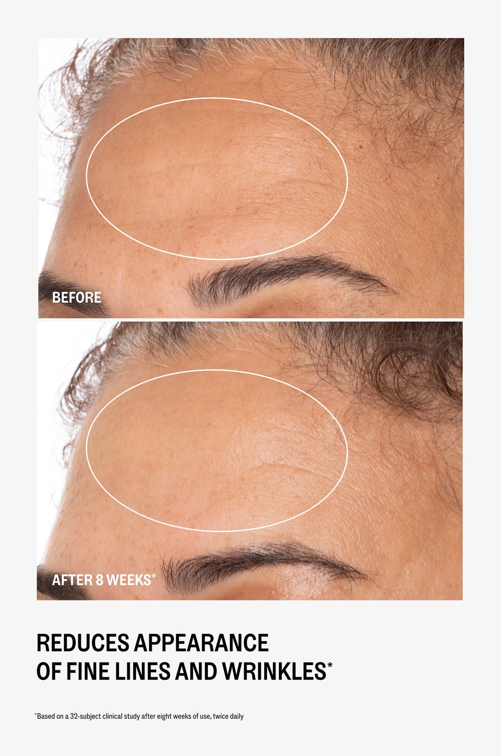 Retinatural+ Advanced Super Serum