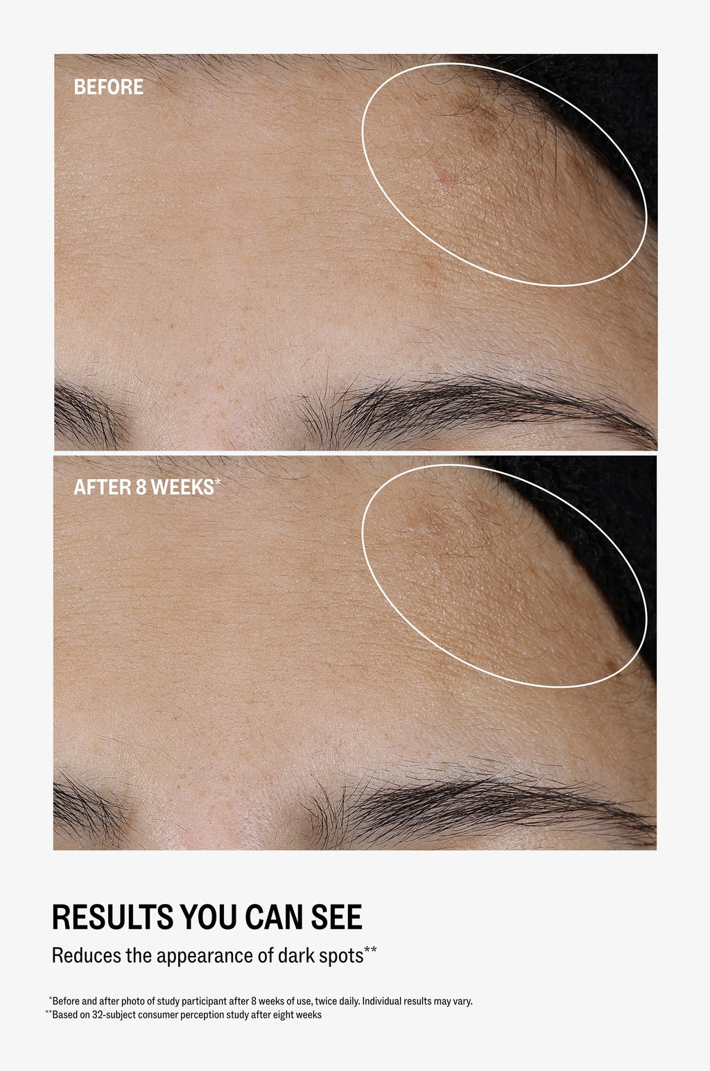 All Bright Vitamin C Serum Gifting