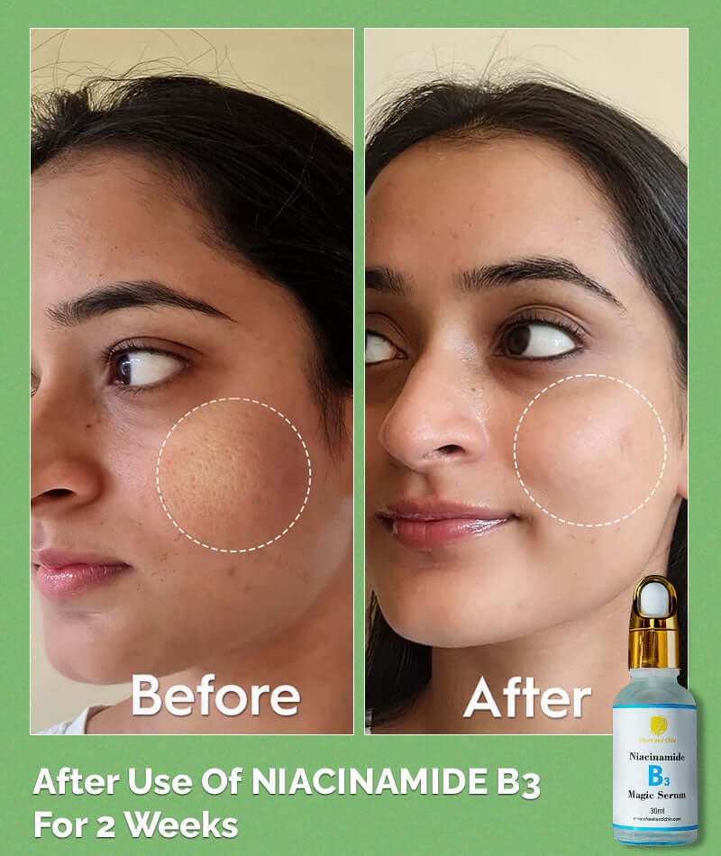 B3 Magic Niacinamide Serum